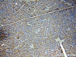 CEPT1 Rabbit anti-Human, Mouse, Rat, Polyclonal, Proteintech 150 &mu;L | Buy Online | Proteintech Group Inc | Fisher Scientific