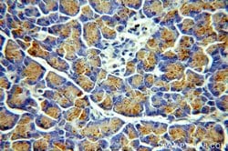 CEPT1 Rabbit anti-Human, Mouse, Rat, Polyclonal, Proteintech 150 &mu;L | Buy Online | Proteintech Group Inc | Fisher Scientific