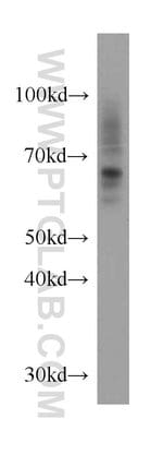 Thumbnail_SLC11A2 Rabbit anti-Human, Mouse, Rat, Polyclonal, Proteintech:Antikörper:Primärantikörper