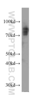 Thumbnail_SLC11A2 Rabbit anti-Human, Mouse, Rat, Polyclonal, Proteintech:Antikörper:Primärantikörper