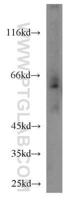 Thumbnail_SLC11A2 Rabbit anti-Human, Mouse, Rat, Polyclonal, Proteintech:Antikörper:Primärantikörper