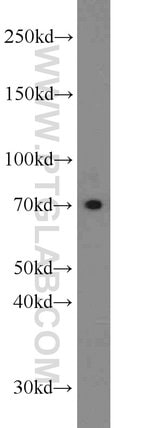 Thumbnail_SLC11A2 Rabbit anti-Human, Mouse, Rat, Polyclonal, Proteintech:Antikörper:Primärantikörper