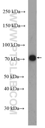 Thumbnail_SLC11A2 Rabbit anti-Human, Mouse, Rat, Polyclonal, Proteintech:Antikörper:Primärantikörper