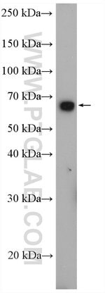 Thumbnail_SLC11A2 Rabbit anti-Human, Mouse, Rat, Polyclonal, Proteintech:Antikörper:Primärantikörper