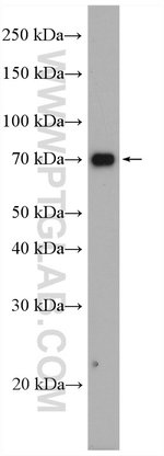 Thumbnail_SLC11A2 Rabbit anti-Human, Mouse, Rat, Polyclonal, Proteintech:Antikörper:Primärantikörper