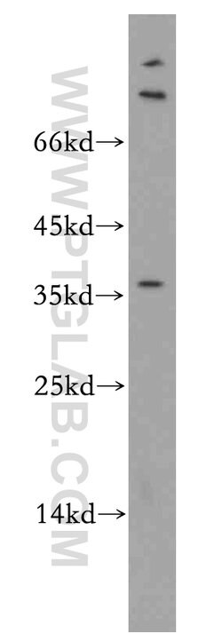 AKR1CL2 Rabbit anti-Human, Mouse, Rat, Polyclonal, Proteintech 20 &mu;L | Buy Online | Proteintech | Fisher Scientific