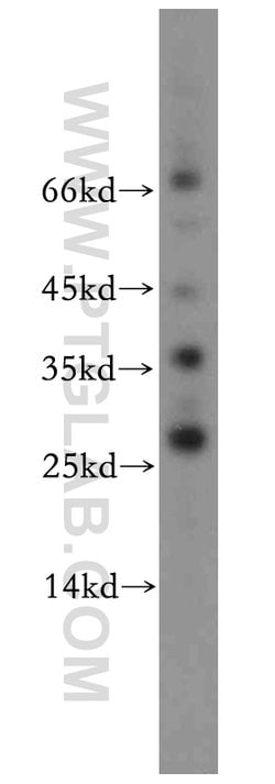 AKR1CL2 Rabbit anti-Human, Mouse, Rat, Polyclonal, Proteintech 20 &mu;L | Buy Online | Proteintech | Fisher Scientific