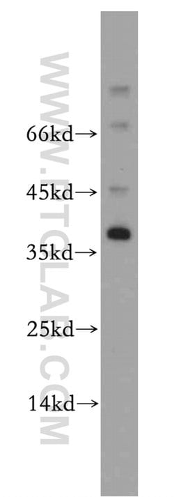 AKR1CL2 Rabbit anti-Human, Mouse, Rat, Polyclonal, Proteintech 20 &mu;L | Buy Online | Proteintech | Fisher Scientific