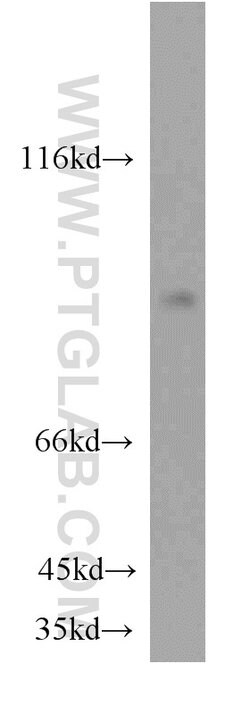 EFS Rabbit anti-Human, Mouse, Rat, Polyclonal, Proteintech 150 &mu;L; Unconjugated:Antibodies,