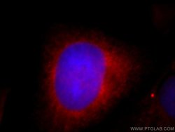 SH3BP1 Rabbit anti-Human, Mouse, Polyclonal, Proteintech:Antibodies:Primary