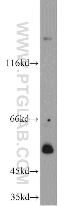 SH3BP1 Rabbit anti-Human, Mouse, Polyclonal, Proteintech:Antibodies:Primary