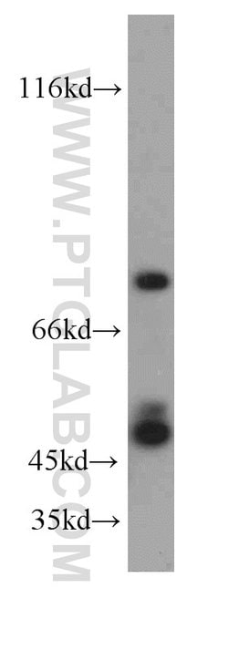 SH3BP1 Rabbit anti-Human, Mouse, Polyclonal, Proteintech:Antibodies:Primary