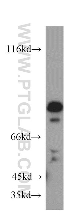 SH3BP1 Rabbit anti-Human, Mouse, Polyclonal, Proteintech:Antibodies:Primary