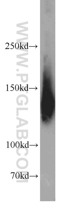 SUPT16H Rabbit anti-Human, Mouse, Polyclonal, Proteintech 150 &mu;L; Unconjugated:Antibodies,