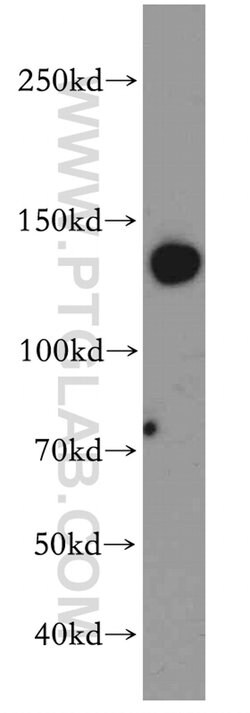 SUPT16H Rabbit anti-Human, Mouse, Polyclonal, Proteintech 150 &mu;L; Unconjugated:Antibodies,