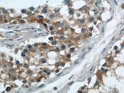 CBLN4 Rabbit anti-Human, Mouse, Rat, Polyclonal, Proteintech 150 &mu;L;