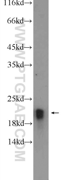 CBLN4 Rabbit anti-Human, Mouse, Rat, Polyclonal, Proteintech 150 &mu;L;