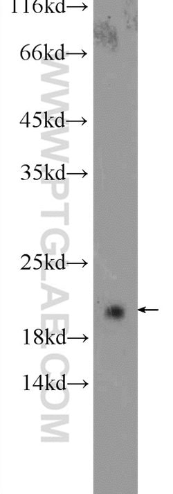 CBLN4 Rabbit anti-Human, Mouse, Rat, Polyclonal, Proteintech 150 &mu;L;