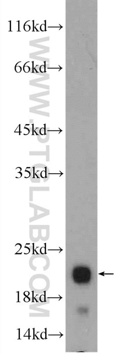 CBLN4 Rabbit anti-Human, Mouse, Rat, Polyclonal, Proteintech 150 &mu;L;