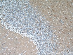 CBLN4 Rabbit anti-Human, Mouse, Rat, Polyclonal, Proteintech 150 &mu;L;