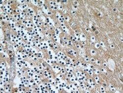 CBLN4 Rabbit anti-Human, Mouse, Rat, Polyclonal, Proteintech 150 &mu;L;