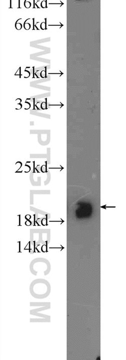 CBLN4 Rabbit anti-Human, Mouse, Rat, Polyclonal, Proteintech 150 &mu;L;