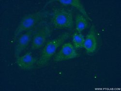 PAFAH1B3 Rabbit anti-Human, Mouse, Rat, Polyclonal, Proteintech 150 &mu;L;