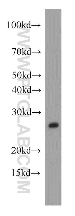 PAFAH1B3 Rabbit anti-Human, Mouse, Rat, Polyclonal, Proteintech 150 &mu;L;