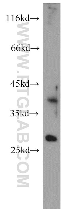 PAFAH1B3 Rabbit anti-Human, Mouse, Rat, Polyclonal, Proteintech 150 &mu;L;