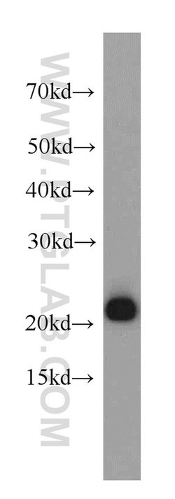 PRDX1 Rabbit anti-Human, Mouse, Rat, Polyclonal, Proteintech:Antikörper:Primärantikörper