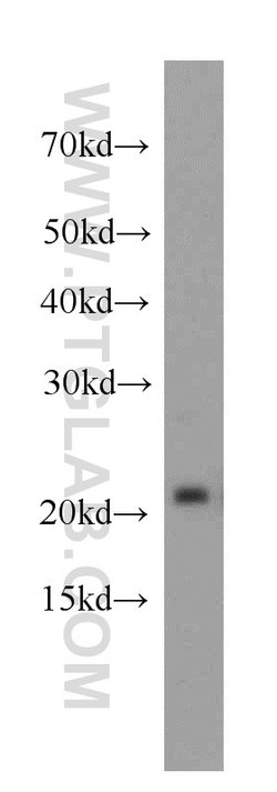 Proteintech PRDX1 Rabbit anti-Human, Mouse, Rat, Polyclonal, Proteintech