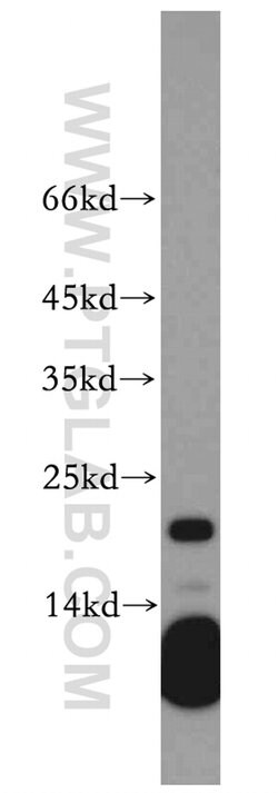 RAC2 Rabbit anti-Human, Mouse, Polyclonal, Proteintech:Antibodies:Primary