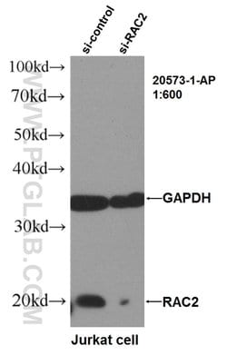 RAC2 Rabbit anti-Human, Mouse, Polyclonal, Proteintech:Antibodies:Primary