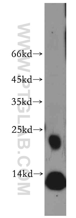 RAC2 Rabbit anti-Human, Mouse, Polyclonal, Proteintech:Antibodies:Primary