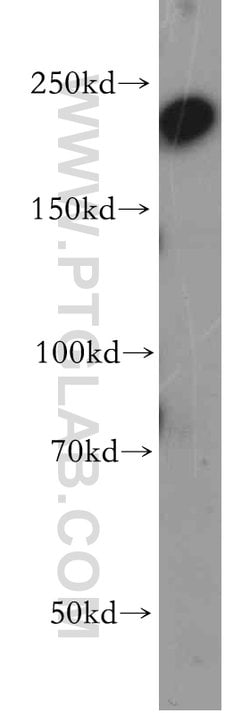 CHD1 Rabbit anti-Human, Mouse, Rat, Polyclonal, Proteintech 150 &mu;L;