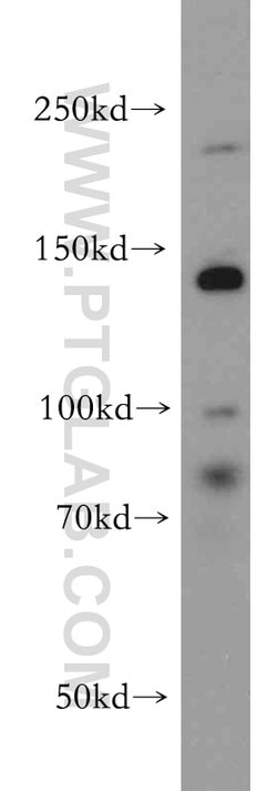 CHD1 Rabbit anti-Human, Mouse, Rat, Polyclonal, Proteintech 150 &mu;L;