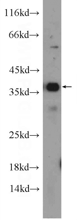 ORAI2 Rabbit anti-Human, Mouse, Polyclonal, Proteintech