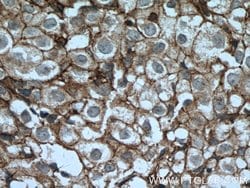 CD9 Rabbit anti-Human, Polyclonal, Proteintech 150 &mu;L; Unconjugated:Antibodies,