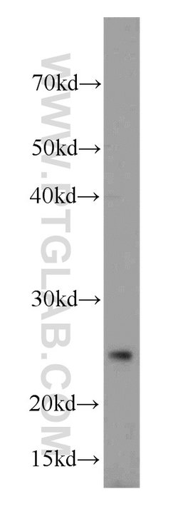 CD9 Rabbit anti-Human, Polyclonal, Proteintech 150 &mu;L; Unconjugated:Antibodies,