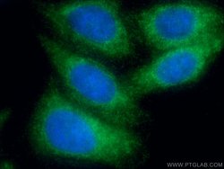 AGPAT9 Rabbit anti-Human, Mouse, Rat, Polyclonal, Proteintech:Antibodies:Primary