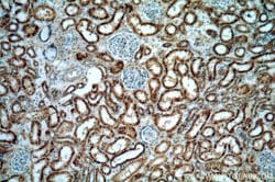 AGPAT9 Rabbit anti-Human, Mouse, Rat, Polyclonal, Proteintech:Antibodies:Primary