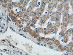 AGPAT9 Rabbit anti-Human, Mouse, Rat, Polyclonal, Proteintech:Antibodies:Primary