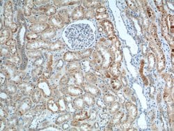 AGPAT9 Rabbit anti-Human, Mouse, Rat, Polyclonal, Proteintech:Antibodies:Primary