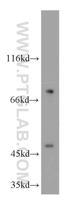 AGPAT9 Rabbit anti-Human, Mouse, Rat, Polyclonal, Proteintech:Antibodies:Primary