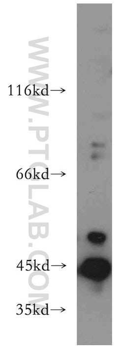 AGPAT9 Rabbit anti-Human, Mouse, Rat, Polyclonal, Proteintech:Antibodies:Primary