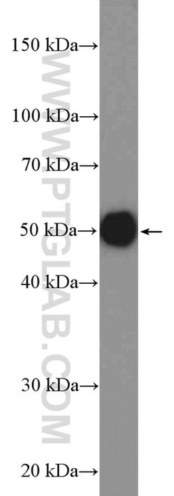 AGPAT9 Rabbit anti-Human, Mouse, Rat, Polyclonal, Proteintech:Antibodies:Primary