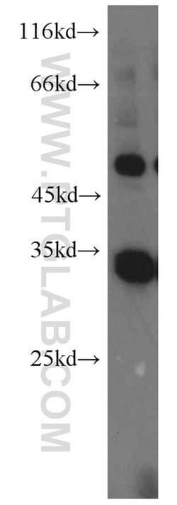 PEX7 Rabbit anti-Human, Mouse, Rat, Polyclonal, Proteintech:Antibodies:Primary