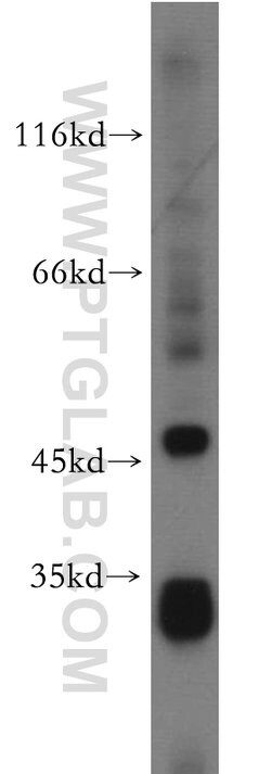 PEX7 Rabbit anti-Human, Mouse, Rat, Polyclonal, Proteintech:Antibodies:Primary