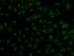 GBA Rabbit anti-Human, Polyclonal, Proteintech 150 &mu;L; Unconjugated:Antibodies,