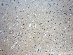 GBA Rabbit anti-Human, Polyclonal, Proteintech 150 &mu;L; Unconjugated:Antibodies,